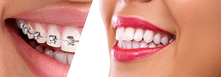 Orthodontist Gilbert AZ Smile